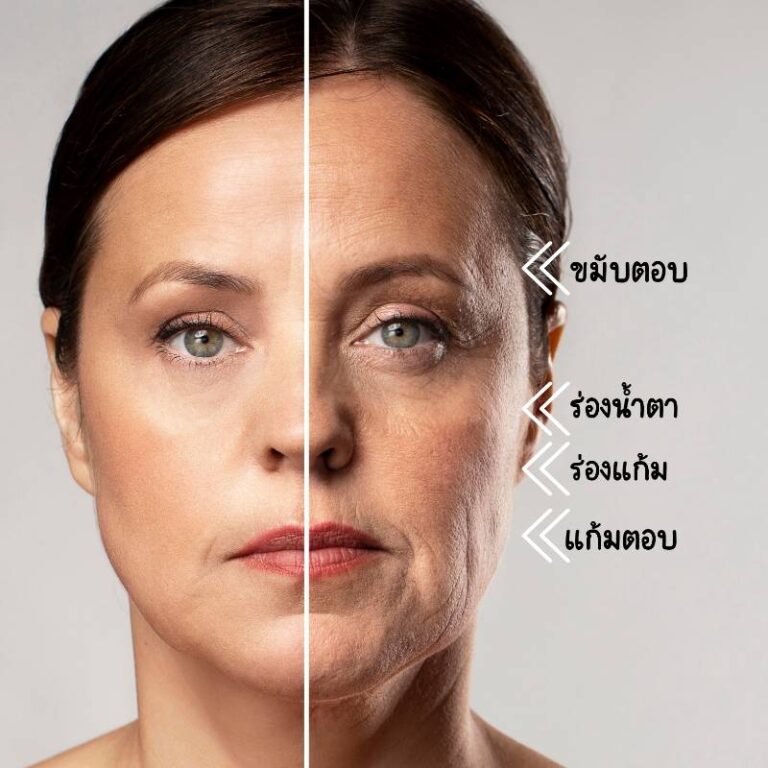 มอเฟียส8 เครื่องยกกระชับใบหน้า มาแรงแห่งปี Estique Clinic